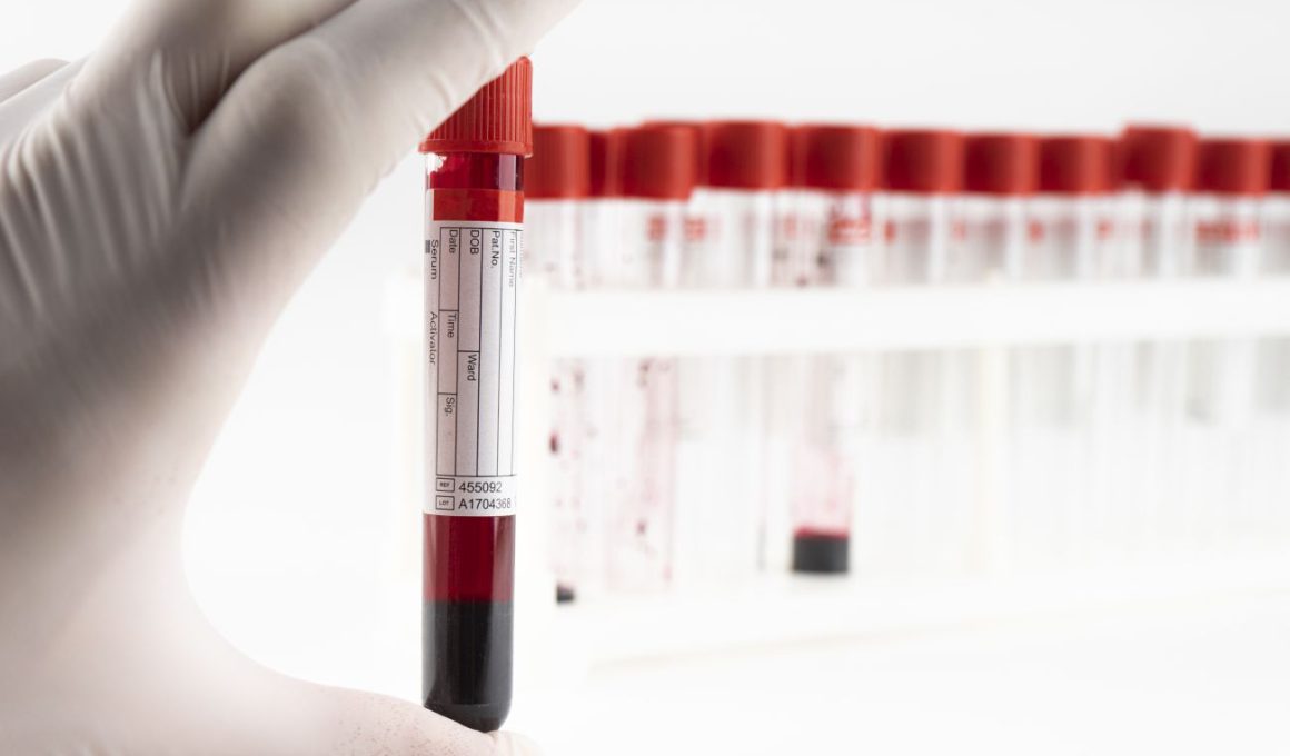 Jak zamówić badanie krwi w domu?